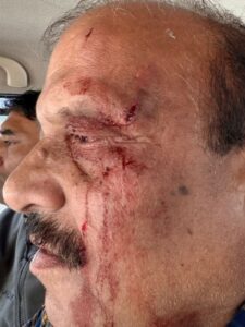 देहरादून: विधायक के सामने प्रारंभिक शिक्षा निदेशक पर हमला, शिक्षकों में भारी रोष